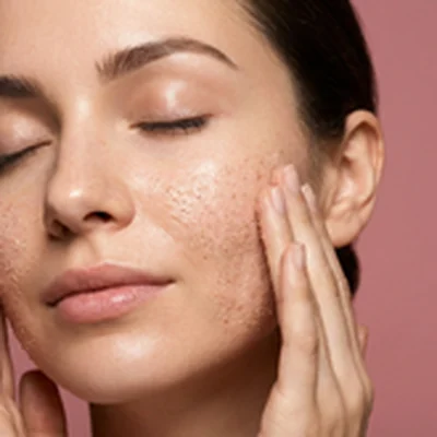 Scrubs & Peels