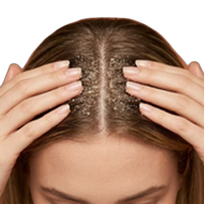 Scalp Scrubs